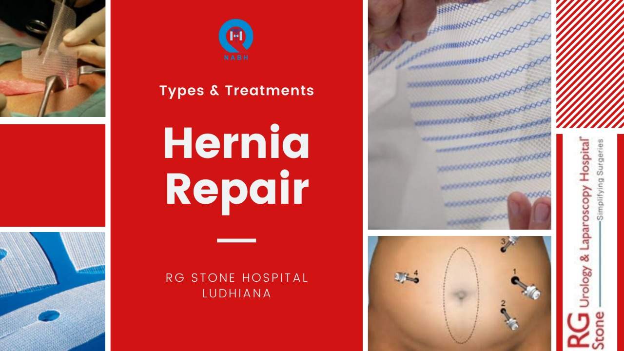 Hernia Repair – Types and Treatments