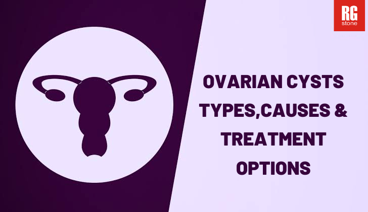 Ovarian cysts types causes treatment options