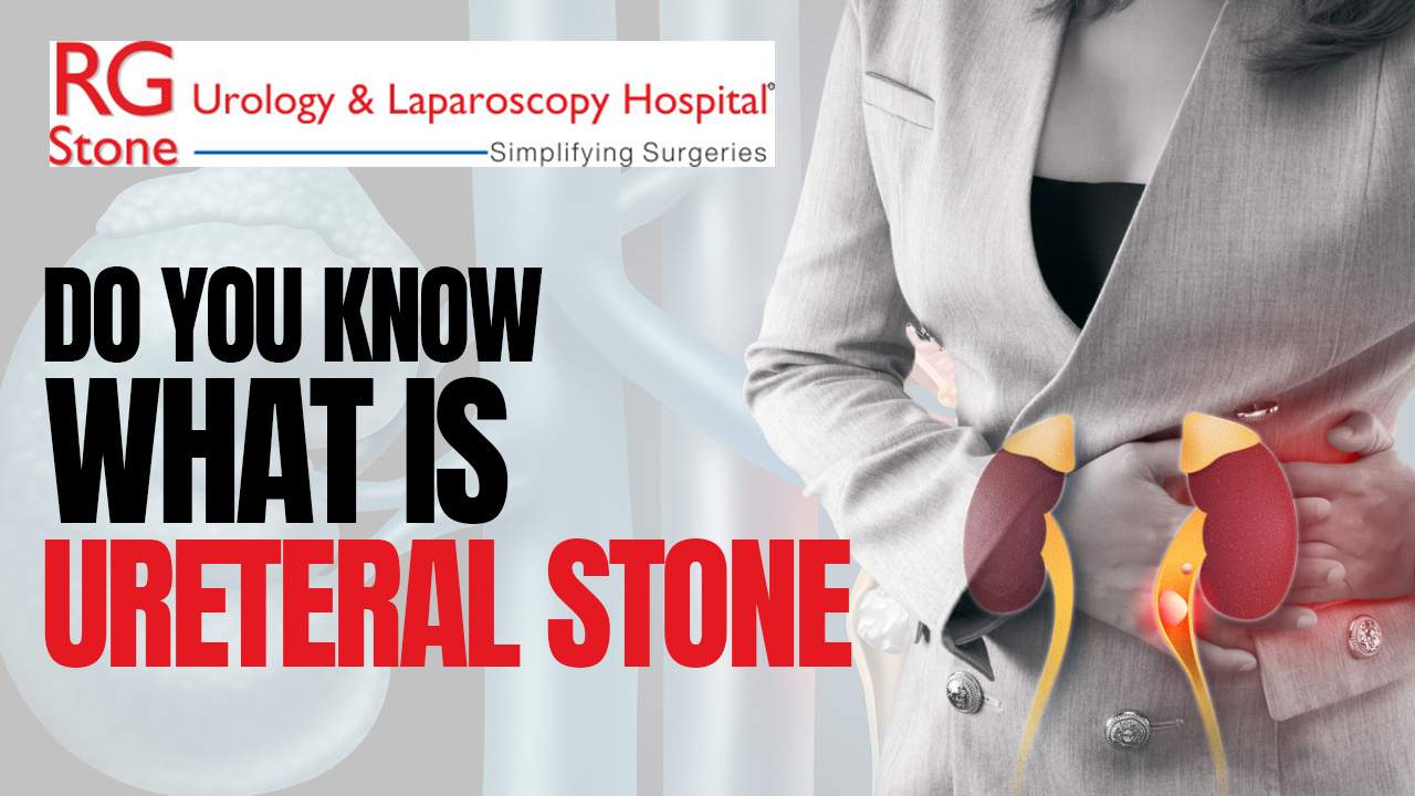 Types Of Ureteral Stones: Symptoms And Causes