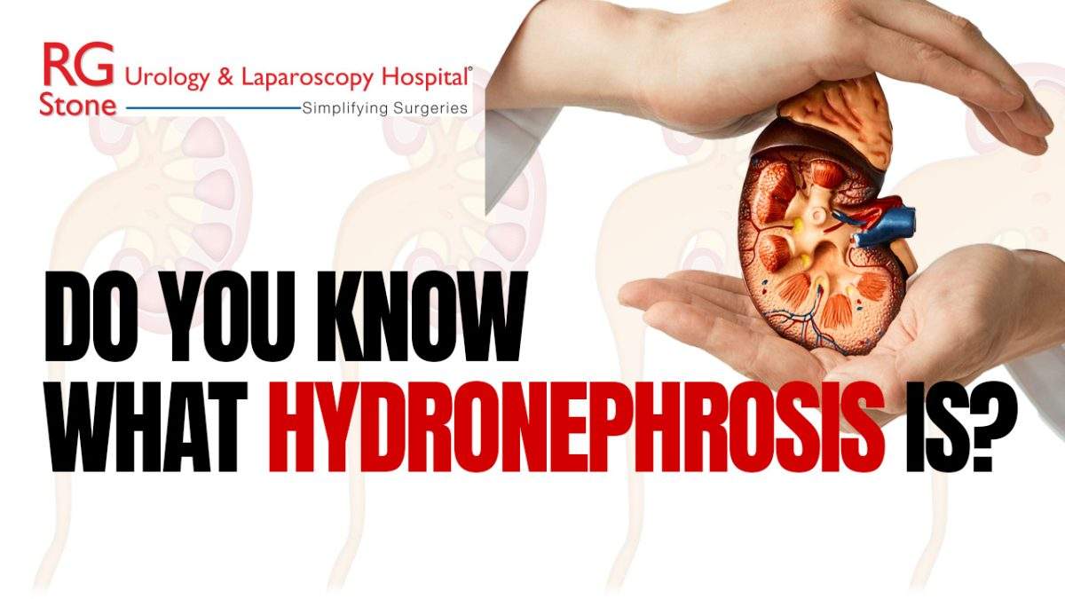Hydronephrosis: symptoms and causes