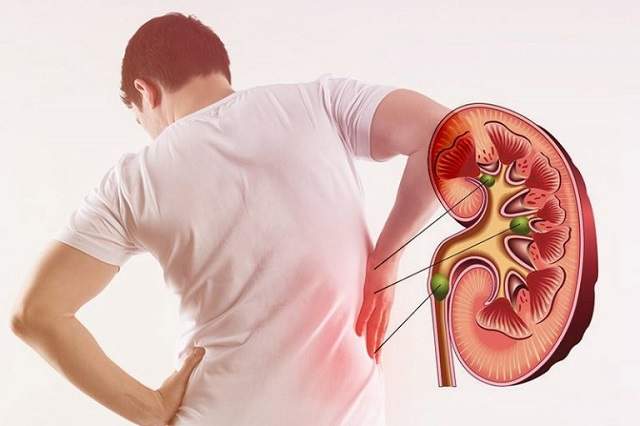 Easy Tips to maintain your kidney health