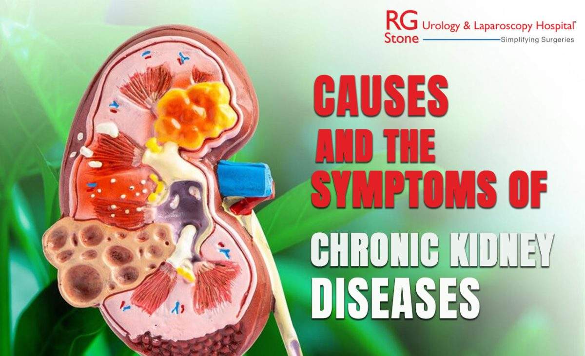 Causes and the symptoms of Chronic kidney diseases